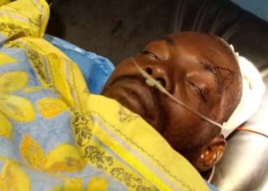 Gabon/Insécurité : un homme se fait charcuter avec une bouteille par un certain “Chat botté”au rond-point de la démocratie